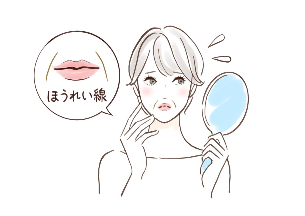 顔のほうれい線の位置を示すイラスト