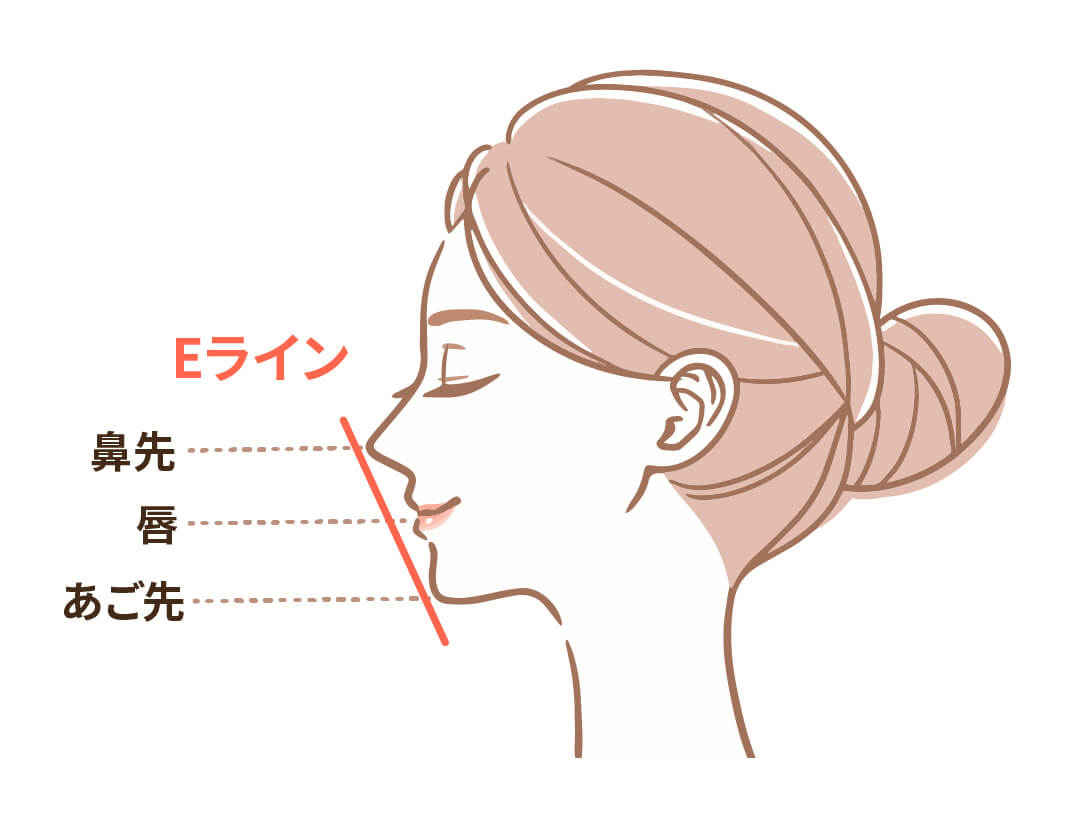 鼻先、唇、あご先を結ぶEライン（エステティックライン）の定義を説明したイラスト