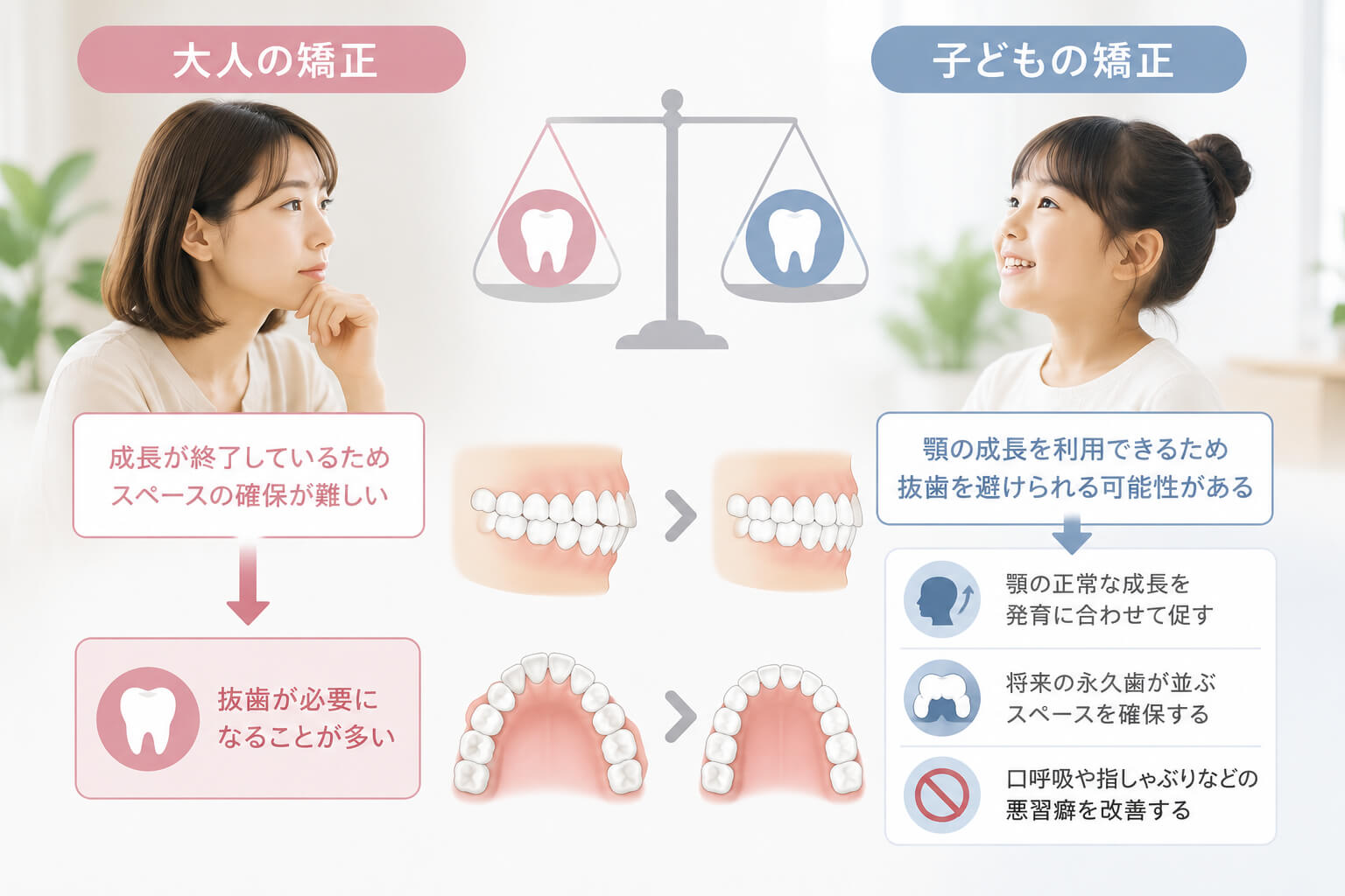 大人と子どもの矯正における抜歯の違い