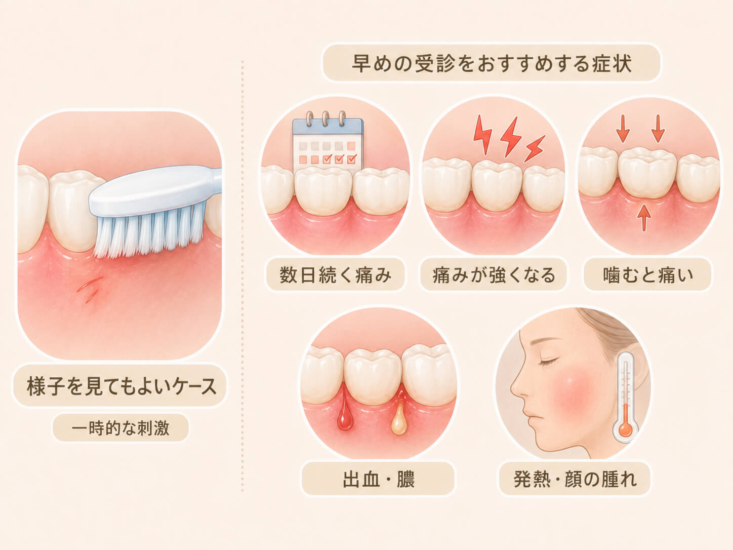 歯茎の痛みで受診の目安を示したイラスト