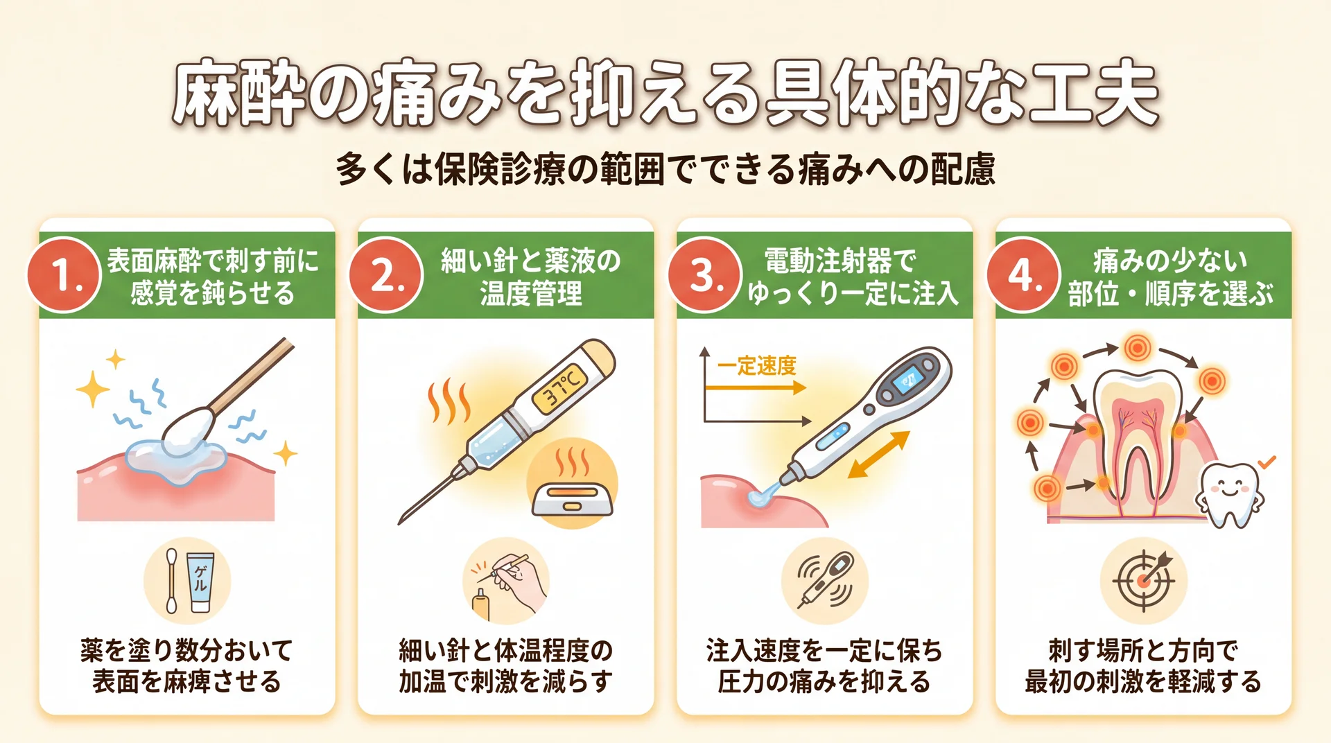 表面麻酔・細い針と薬液の加温・電動注射器・部位選択という麻酔の痛みを抑える4つの工夫を整理した図解