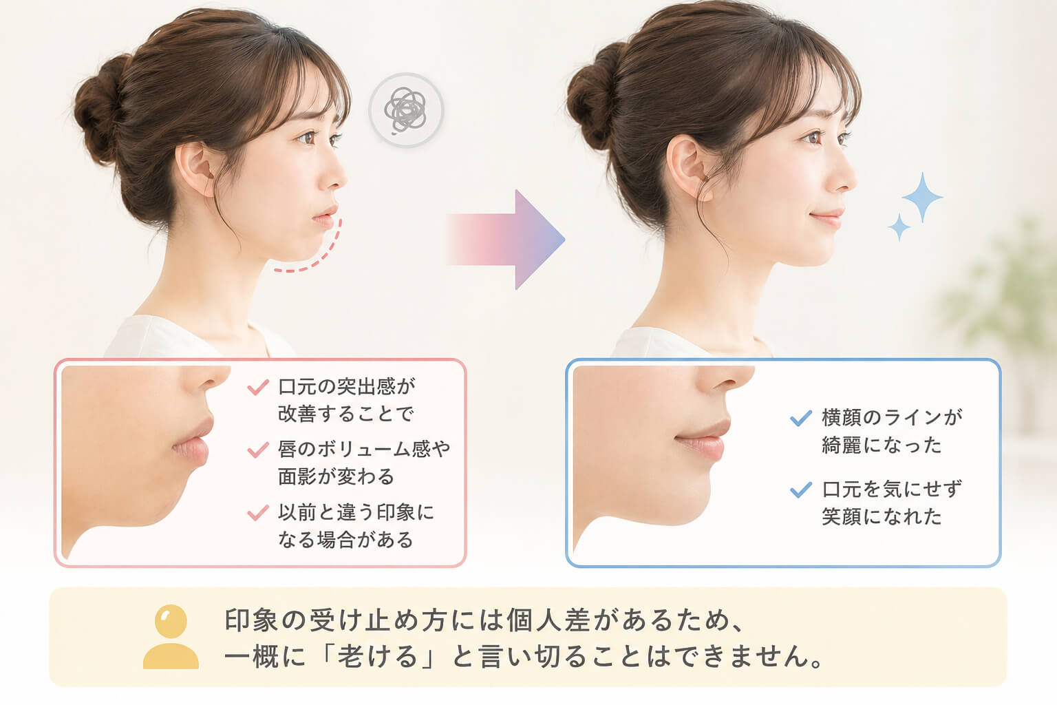 歯列矯正による口元と横顔の印象変化を示す図解