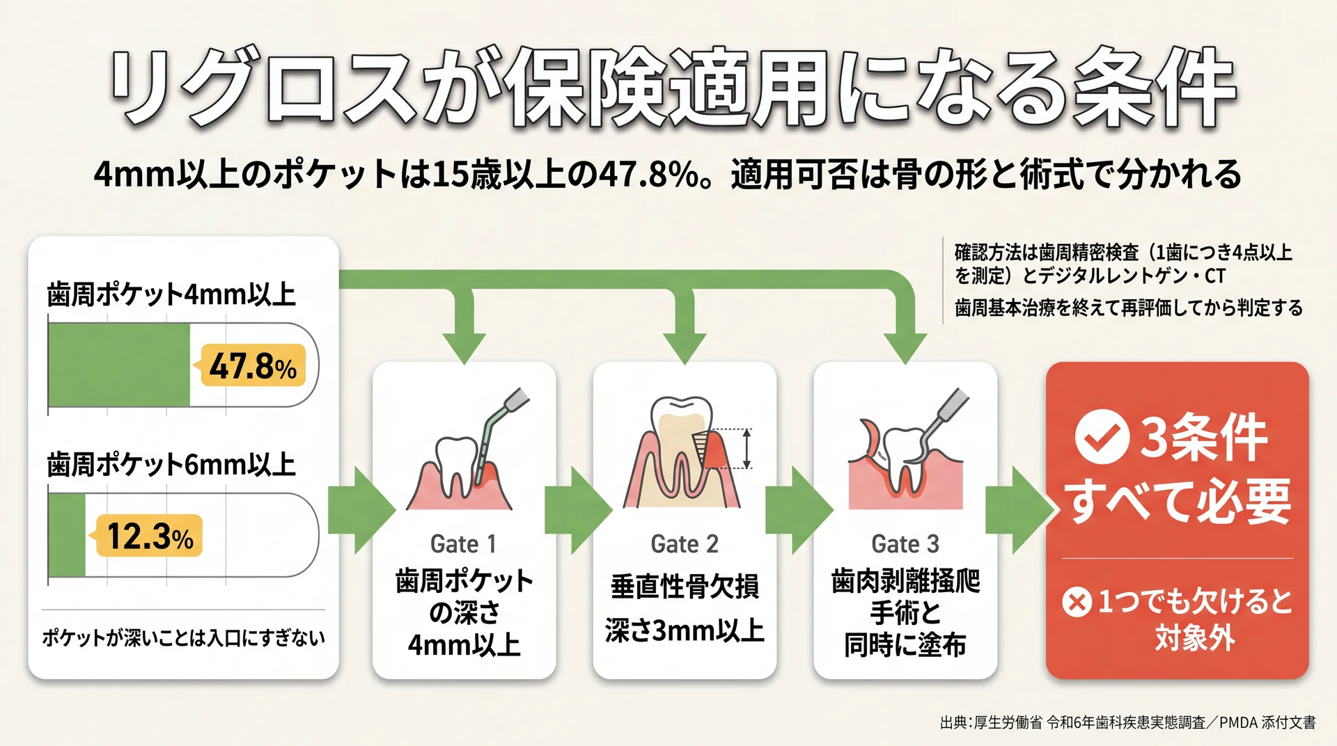 歯周ポケット4mm以上47.8%・6mm以上12.3%の分布と、保険適用に必要な3条件の判定フロー図