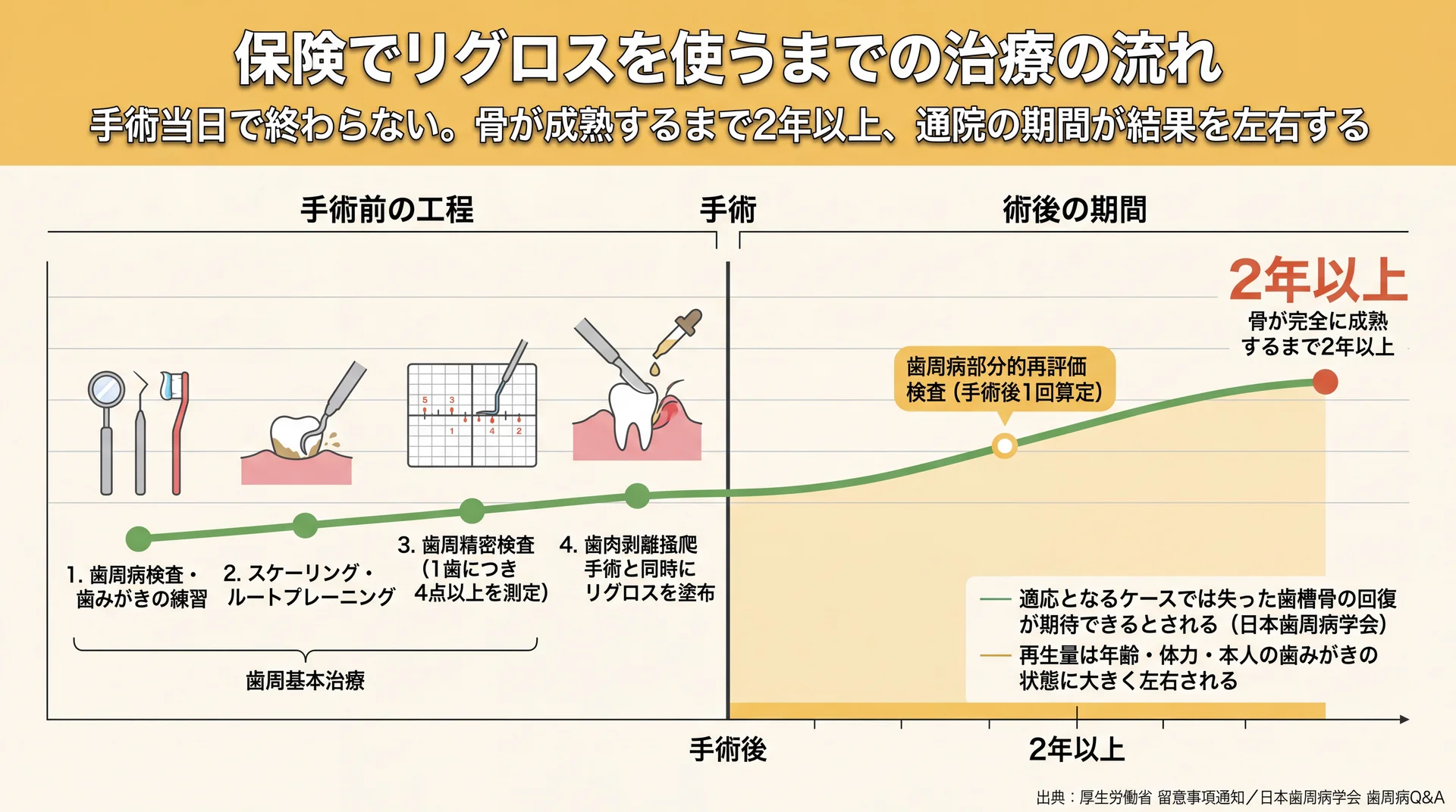 歯周基本治療から歯周精密検査・手術を経て骨の成熟に2年以上かかる治療期間のタイムライン