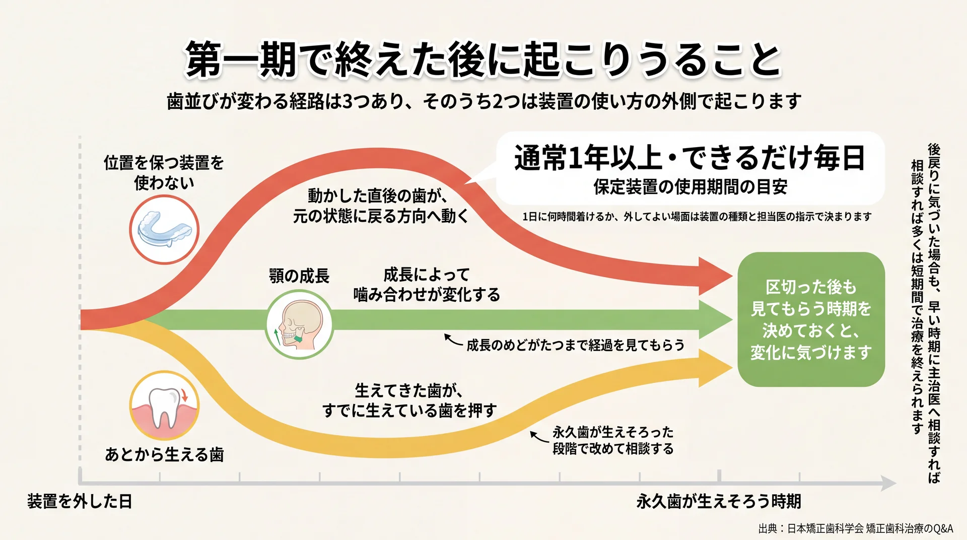 装置を外した後に歯並びが変わる3つの経路と、保定装置は通常1年以上できるだけ毎日という目安を示した図